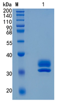 Active Recombinant Mouse Kallikrein 7 / KLK7 Protein