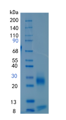 Active Recombinant Human Kallikrein 6 / KLK6 / Neurosin Protein