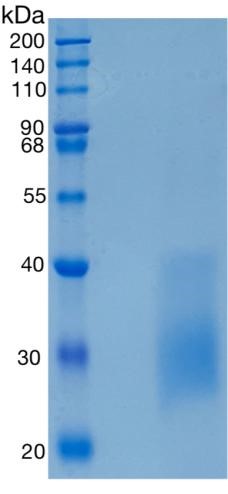 Active Recombinant Human HVEM / TNFRSF14 / CD270 Protein