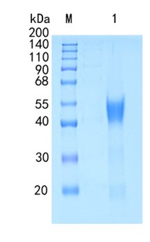 Active Recombinant Human IL-22BP / IL-22RA2 Protein