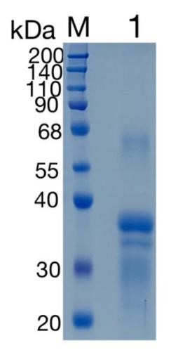 Active Recombinant Human RGMa / Repulsive Guidance Molecule A Protein