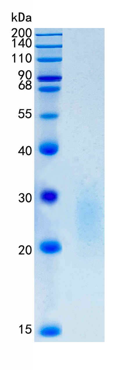 Active Recombinant Human TMIGD2 / IGPR1 / CD28H Protein
