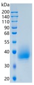 Active Recombinant Human SLAMF6 / CD352 / NTBA Protein