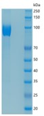 Active Recombinant Human IL-17RA / CD217 Protein