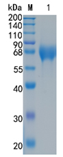 Active Recombinant Human TIM-4 / TIMD4 Protein