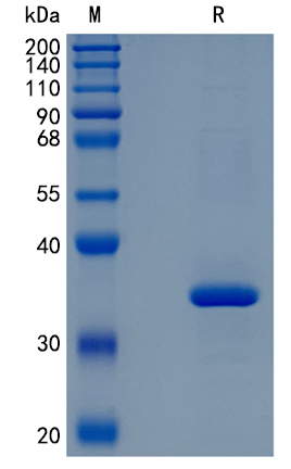 Active Recombinant Human sFRP-2 / SFRP2 Protein