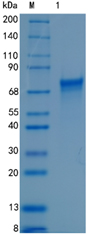 Active Recombinant Human CNDP1 / Carnosine dipeptidase 1 Protein