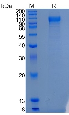 Active Recombinant Human SLITRK1 Protein