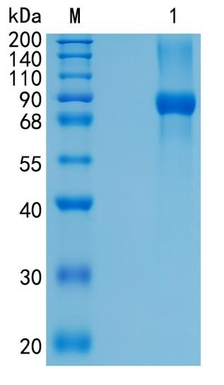 Active Recombinant Human HIP / Huntingtin interacting protein Protein