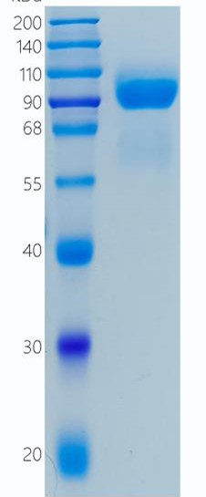 Active Recombinant Human G-CSFR / CD114 / CSF3R Protein