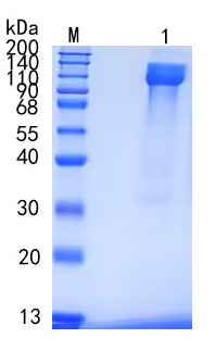 Active Recombinant Human OSMR / OSMR beta Protein