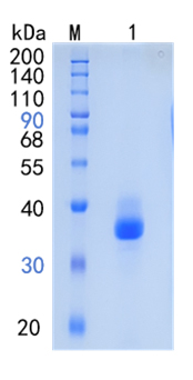Active Recombinant Human Chymotrypsin / CTRC Protein