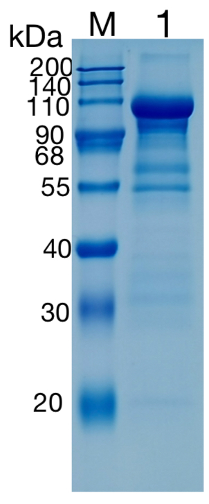 Active Recombinant Human Semaphorin 3C / SEMA3C Protein