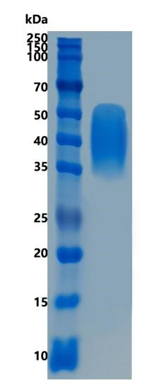 Active Recombinant Human PD-L2 / B7-DC / CD273 Protein