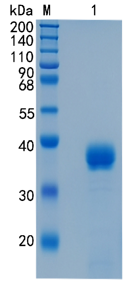 Active Recombinant Human Angiopoietin-like 4 / ANGPTL4 Protein