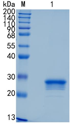 Active Recombinant Human ULBP-3 / RAET1B Protein