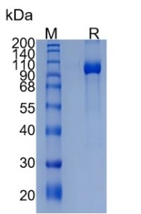Active Recombinant Human Nogo Receptor / RTN4R Protein