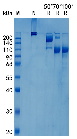 Active Recombinant Human Semaphorin 4C / SEMA4C Protein