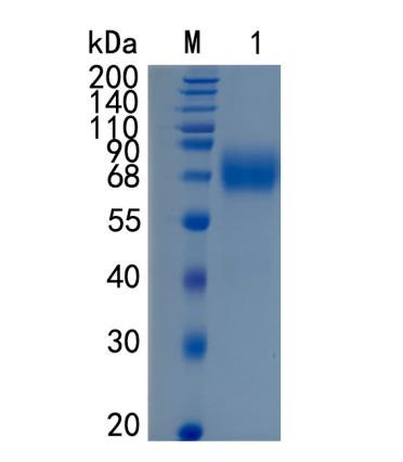 Active Recombinant Mouse IL-1Rrp2 / IL-1R6 Protein