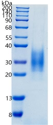 Active Recombinant Human IL-22 / Interleukin-22 Protein