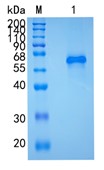 Active Recombinant Human SMOC1 / SPARC-related modular calcium-binding protein 1 Protein
