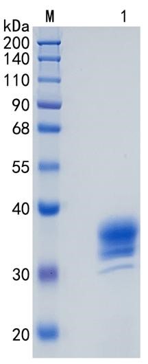 Active Recombinant Human ASAM / ACER2 Protein
