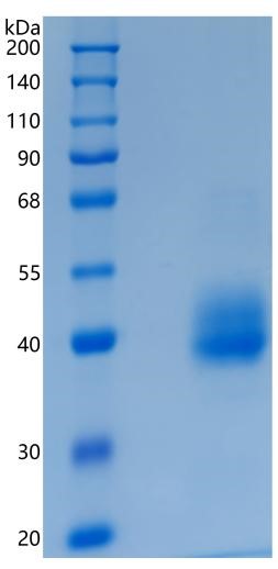 Active Recombinant Human TEM8 / ANTXR1 Protein