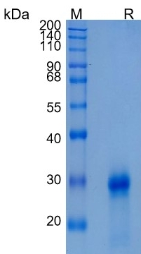 Active Recombinant Human EDA2R / XEDAR / TNFRSF27 Protein
