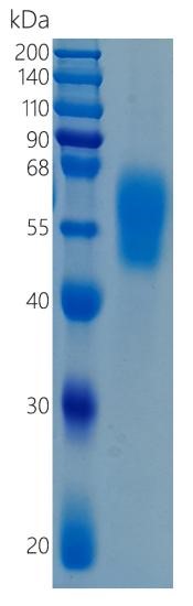 Active Recombinant Human IL-36R / IL-1Rrp2 Protein