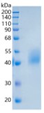 Active Recombinant Human IL-21R / CD360 Protein