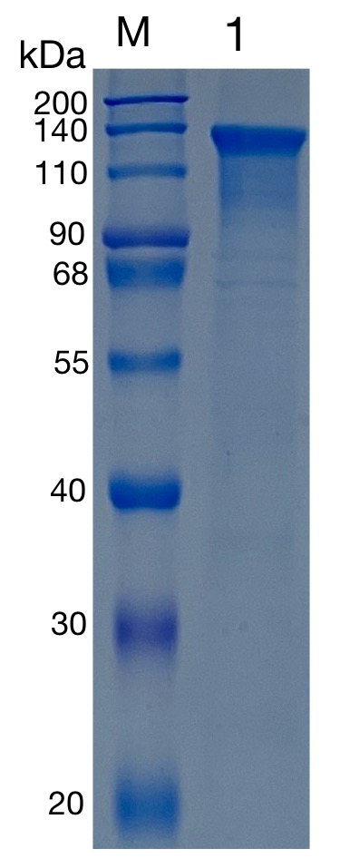 Active Recombinant Human TEM1 / Endosialin / CD248 Protein