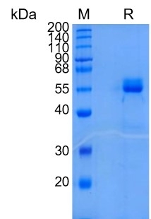 Active Recombinant Human / Mouse Frizzled-2 / FZD2 Protein