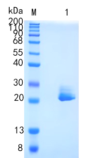 Active Recombinant Mouse FGF-21 / FGF21 Protein