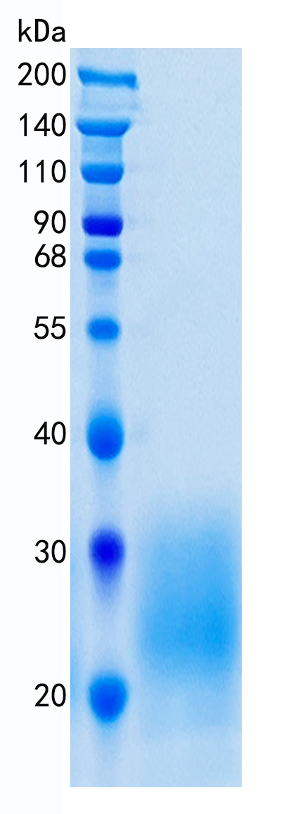 Active Recombinant Mouse IL-22 / Interleukin-22 Protein