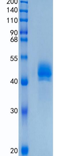 Active Recombinant Human DC-SIGN / CD209 / CLEC4L Protein