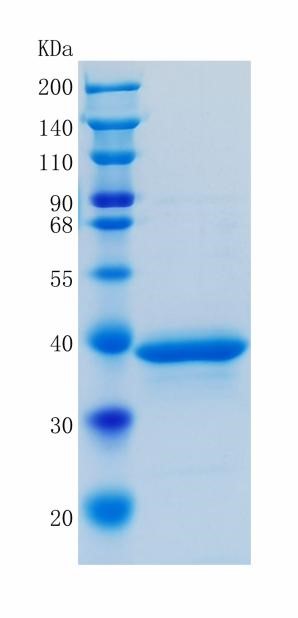 Active Recombinant Human TWEAK R / TNFRSF12A / CD266 Protein