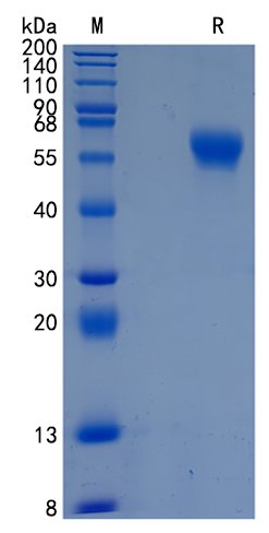 Active Recombinant Human IL-1R3 / IL-1RAcP Protein