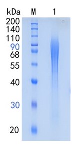 Active Recombinant Human ESM1 / Endocan Protein