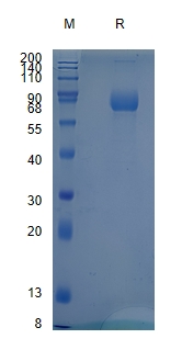 Active Recombinant Human IL-17RB / IL-17 Receptor B Protein