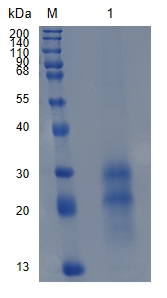 Active Recombinant Human TNFRSF19 / TROY Protein