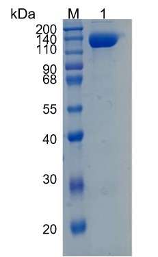 Active Recombinant Human Semaphorin 5B / SEMA5B Protein