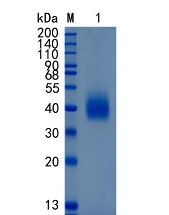 Active Recombinant Mouse SLAM / CD150 / SLAMF1 Protein
