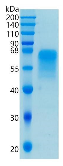 Active Recombinant Human DcR2 / TNFRSF10D / CD264 Protein