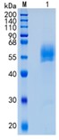Active Recombinant Human Dkk-3 / DKK3 Protein