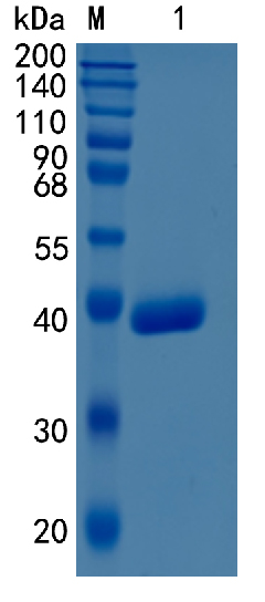 Active Recombinant Human Cathepsin Z / CTSZ Protein