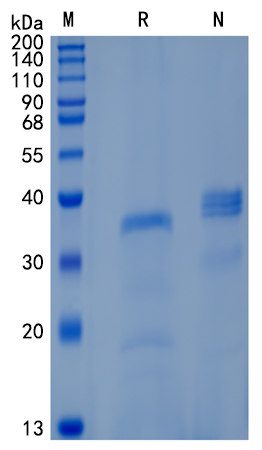 Active Recombinant Human Dkk-4 / DKK4 Protein