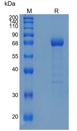 Active Recombinant Human EphA6 / Eph receptor A6 Protein