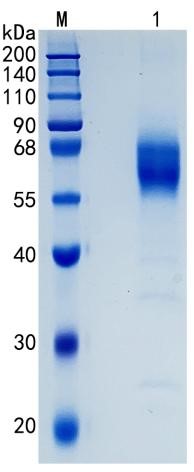 Active Recombinant Human CD300a / CMRF-35H Protein