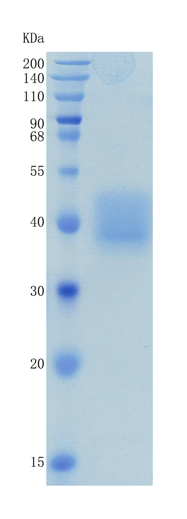 Active Recombinant Human CD84 / SLAMF5 Protein
