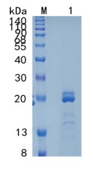 Active Recombinant Human ZNRF3 Protein